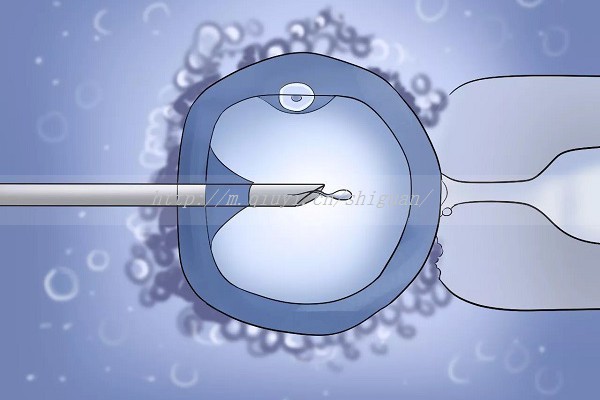 做试管检测HIV吗_做试管婴儿检查艾滋病吗