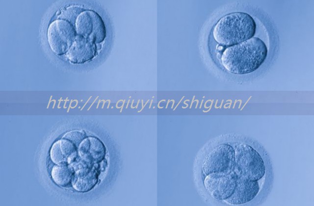 习惯性流产做试管有用吗？