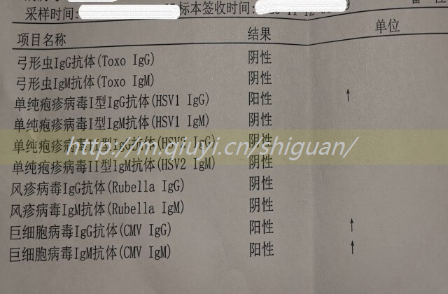 做试管前查出盆腔积液30mm两处？