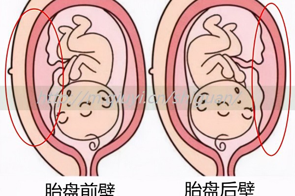 做试管必查染色体吗_做试管需要检查染色体吗