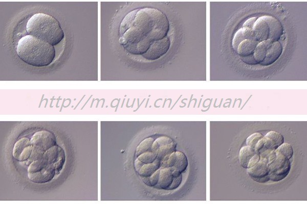做试管婴儿内膜转化成什么激素