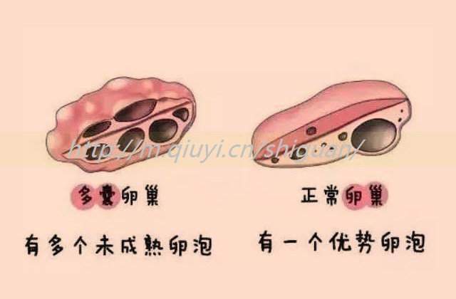 做试管婴儿查出来艾滋准确吗,做试管要筛查艾滋病吗