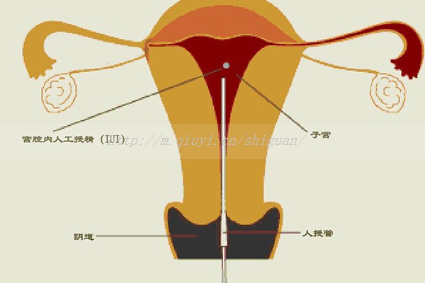 做试管促排卵泡不长了_试管婴儿促排卵泡不长