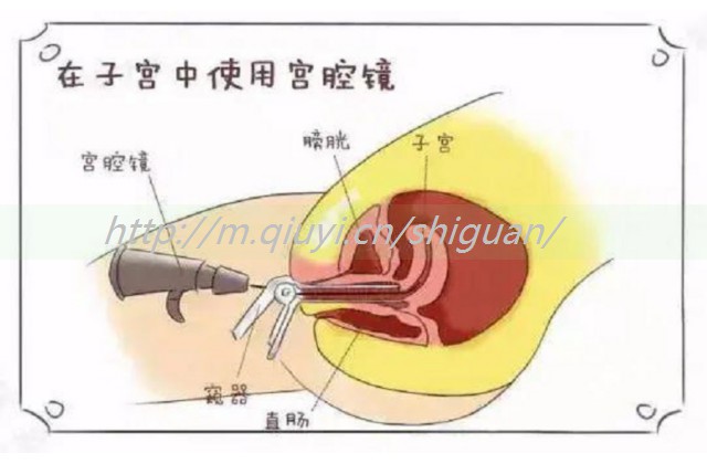 少精无精可以做试管婴儿吗-少精能做试管婴儿吗